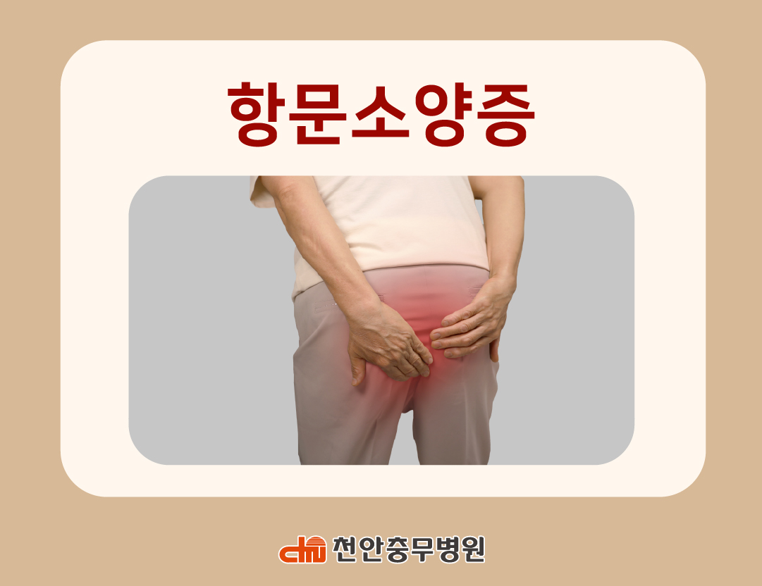 [전문의 칼럼] 항문소양증